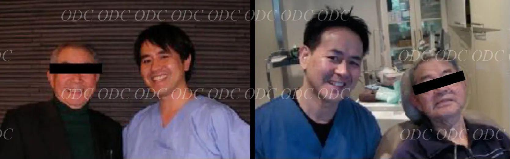 インプラント補綴（上部構造）